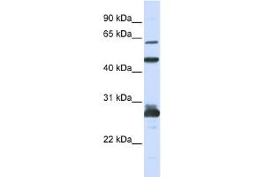 WB Suggested Anti-PES1 Antibody Titration: 0. (PES1 antibody  (C-Term))