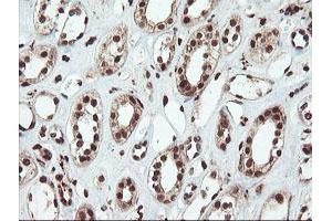 Immunohistochemical staining of paraffin-embedded Human Kidney tissue using anti-SAMHD1 mouse monoclonal antibody. (SAMHD1 antibody)