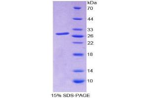 SDS-PAGE (SDS) image for SP140 Nuclear Body Protein (SP140) (AA 443-655) protein (His tag) (ABIN2126813) (SP140 Protein (AA 443-655) (His tag))