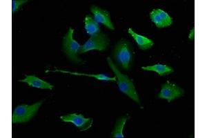 Immunofluorescence staining of U251 cells with ABIN7151510 at 1:133, counter-stained with DAPI. (ERC1 antibody  (AA 1-224))