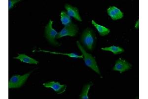 Immunofluorescence staining of U251 cells with ABIN7151510 at 1:133, counter-stained with DAPI. (ERC1 antibody  (AA 1-224))