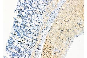 ABIN6262790 and ABIN6278915 at 1/100 staining Rat stomach tissue by IHC-P. (KRT9 antibody  (Internal Region))