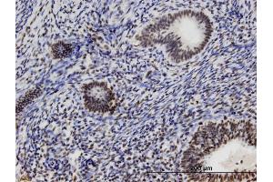 Immunoperoxidase of monoclonal antibody to ZFC3H1 on formalin-fixed paraffin-embedded human endometrium. (ZFC3H1 antibody  (AA 1-358))