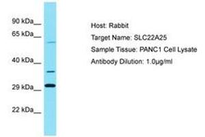 Image no. 1 for anti-Solute Carrier Family 22, Member 25 (SLC22A25) (AA 271-320) antibody (ABIN6750804) (SLC22A25 antibody  (AA 271-320))
