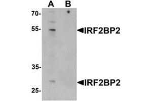 Western blot analysis of IRF2BP2 in HeLa cell lysate with IRF2BP2 Antibody  at 1 ug/mL in (A) the absence and (B) the presence of blocking peptide. (IRF2BP2 antibody  (C-Term))