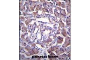 PRSS3 Antibody (Center) (ABIN655869 and ABIN2845275) immunohistochemistry analysis in formalin fixed and paraffin embedded human pancreas tissue followed by peroxidase conjugation of the secondary antibody and DAB staining. (PRSS3 antibody  (AA 136-163))