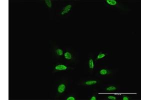 Immunofluorescence of purified MaxPab antibody to PRRX2 on HeLa cell.