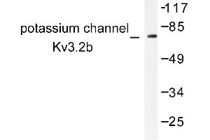 Image no. 2 for anti-Potassium Voltage-Gated Channel, Shaw-Related Subfamily, Member 2 (KCNC2) antibody (ABIN271788)