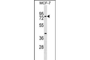 TOX4 Antibody (N-term) (ABIN1539120 and ABIN2849246) western blot analysis in MCF-7 cell line lysates (35 μg/lane). (TOX4 antibody  (N-Term))