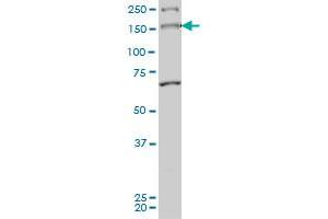 MYO3A monoclonal antibody (M01), clone 8D12 Western Blot analysis of MYO3A expression in Hela S3 NE . (MYO3A antibody  (AA 1400-1490))