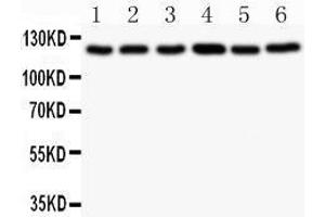 Observed bind size: 122KD (BUB1 antibody  (AA 731-1085))