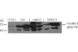 Image no. 2 for anti-Keratin 8 (KRT8) (pSer74) antibody (ABIN401538) (KRT8 antibody  (pSer74))