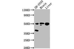Western Blot Positive WB detected in: SH-SY5Y whole cell lysate, Rat brain tissue, Rat liver tissue All lanes: SEPT11 antibody at 1:2000 Secondary Goat polyclonal to rabbit IgG at 1/50000 dilution Predicted band size: 50, 51 kDa Observed band size: 50 kDa (Septin 11 antibody  (AA 237-429))