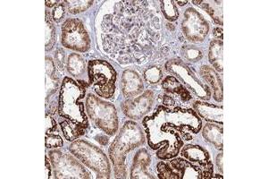 Immunohistochemical staining of human kidney with SLC35F4 polyclonal antibody  shows strong cytoplasmic positivity in cells in tubules at 1:200-1:500 dilution.