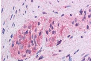 Human Colon, Myenteric Plexus: Formalin-Fixed, Paraffin-Embedded (FFPE) (WNT5A antibody  (AA 180-229))