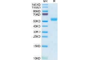 Biotinylated Cynomolgus BAFF Trimer on Tris-Bis PAGE under reduced condition. (BAFF Protein (AA 141-285, Trimer) (His-Avi Tag,DYKDDDDK Tag,Biotin))