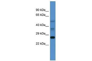 Western Blot showing Commd2 antibody used at a concentration of 1-2 ug/ml to detect its target protein. (COMMD2 antibody  (Middle Region))
