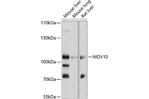 Western blot analysis of extracts of various cell lines, using MOV10 antibody (ABIN1680885, ABIN3018353, ABIN3018354 and ABIN6220441) at 1:1000 dilution. (MOV10 antibody  (AA 1-310))