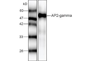 Western blot analysis of recombinant AP2 gamma, using AP2 gamma antibody (1/1000 dilution). (TFAP2C antibody)