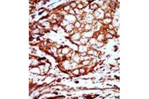 Image no. 2 for anti-14-3-3 alpha + beta (YWHAB) (C-Term) antibody (ABIN360672) (YWHAB antibody  (C-Term))