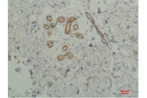 Immunohistochemistry (IHC) analysis of paraffin-embedded Human SkinTissue using STAT2 Rabbit Polyclonal Antibody diluted at 1:200.