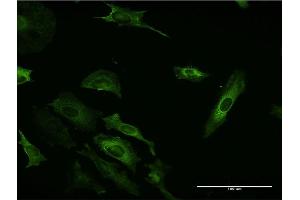 Immunofluorescence (IF) image for anti-Phosphatidylinositol-4-Phosphate 3-Kinase, Catalytic Subunit Type 2 beta (PIK3C2B) (AA 1-110) antibody (ABIN518887)