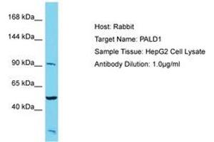 Image no. 1 for anti-Phosphatase Domain Containing, Paladin 1 (PALD1) (AA 143-192) antibody (ABIN6750572) (KIAA1274 antibody  (AA 143-192))