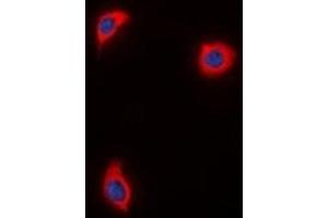 Immunofluorescent analysis of AKAP1 staining in HuvEc  cells. (AKAP1 antibody)