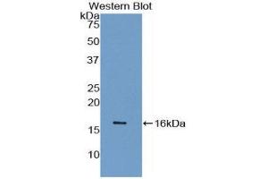 Western Blotting (WB) image for anti-Synuclein, gamma (Breast Cancer-Specific Protein 1) (SNCG) (AA 1-115) antibody (ABIN1078560) (SNCG antibody  (AA 1-115))