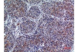 Immunohistochemistry (IHC) analysis of paraffin-embedded Human Lung, antibody was diluted at 1:100. (LILRA1 antibody  (N-Term))