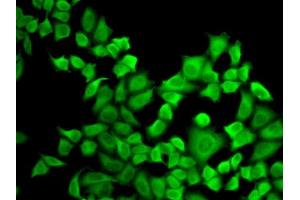 Immunofluorescence analysis of A-549 cells using DHFR antibody (ABIN3022227, ABIN3022228, ABIN3022229 and ABIN6218683). (Dihydrofolate Reductase antibody  (AA 1-187))