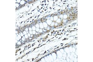 Immunohistochemistry of paraffin-embedded human colon using [KO Validated] SIRT1 Rabbit pAb (ABIN6129328, ABIN6147784, ABIN6147785 and ABIN6215138) at dilution of 1:200 (40x lens). (SIRT1 antibody  (AA 448-747))