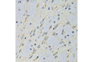 Immunohistochemistry of paraffin-embedded mouse brain using DARS antibody. (DARS antibody  (AA 222-501))