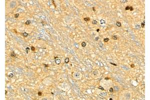 ABIN6259156 and ABIN6275313 at 1/100 staining Rat brain tissue by IHC-P.