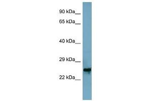 MRPL48 antibody used at 1 ug/ml to detect target protein. (MRPL48 antibody  (Middle Region))