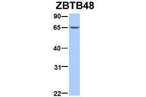 Host:  Rabbit  Target Name:  ZBTB48  Sample Type:  293T  Antibody Dilution:  1. (ZBTB48 antibody  (N-Term))