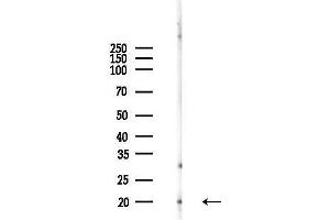 anti-Peripheral-Type Benzodiazepine Receptor (TSPO) (C-Term) antibody