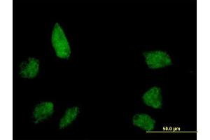 Immunofluorescence of purified MaxPab antibody to BANP on HeLa cell. (BANP antibody  (AA 1-469))