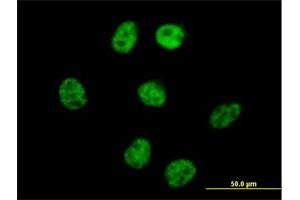 Immunofluorescence (IF) image for anti-A Kinase (PRKA) Anchor Protein 8 (AKAP8) (AA 1-692) antibody (ABIN523683)