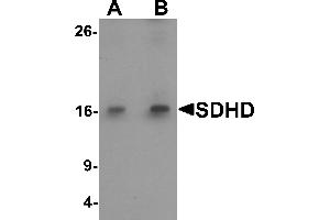 Western blot analysis of SDHD in EL4 cell lysate with SDHD antibody at (A) 1 and (B) 2 µg/mL. (SDHD antibody  (Middle Region))