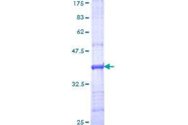 C5 Protein (AA 1550-1661) (GST tag)