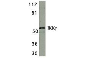 Western Blotting (WB) image for anti-Inhibitor of kappa Light Polypeptide Gene Enhancer in B-Cells, Kinase gamma (IKBKG) (C-Term) antibody (ABIN1030433) (IKBKG antibody  (C-Term))