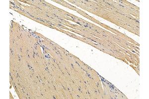 ABIN7096273 and ABIN7100335 at 1/100 staining rat muscle tissue by IHC-P. (VWA5B2 antibody)