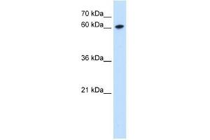 Western Blot showing ZNF169 antibody used at a concentration of 0. (ZNF169 antibody  (Middle Region))