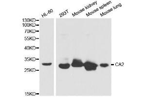 Western blot analysis of extracts of various cell lines, using CA2 antibody. (CA2 antibody  (AA 1-250))