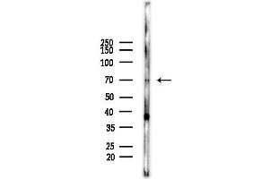 Western blot analysis of lysates from  cells(starvation,24h treatment), using CCDC22 Antibody at 1/1000 dilution.