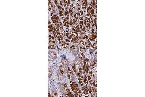 Immunohistochemical staining of human stomach with KCNG1 polyclonal antibody  shows strong cytoplasmic positivity in glandular cells. (KCNG1 antibody)