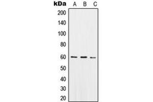 Western blot analysis of SNX4 expression in THP1 (A), Raw264. (Sorting Nexin 4 antibody  (Center))