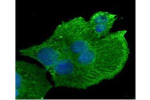 ICC/IF analysis of CD29 in HepG2 cells line, stained with DAPI (Blue) for nucleus staining and monoclonal anti-human CD29 antibody (1:100) with goat anti-mouse IgG-Alexa fluor 488 conjugate (Green). (ITGB1 antibody  (AA 34-141))