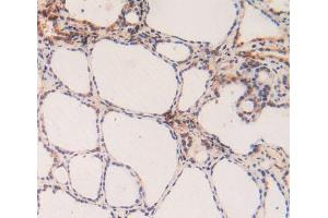 Figure. (Caspase 3 antibody  (AA 29-175))